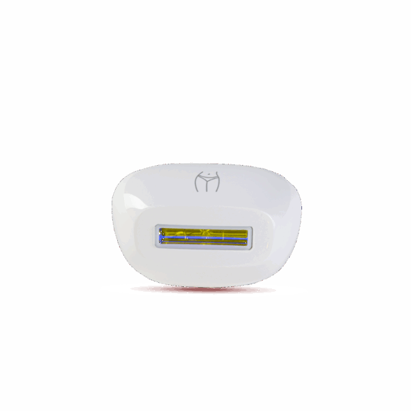 Mismon Sensitive Areas - Lens